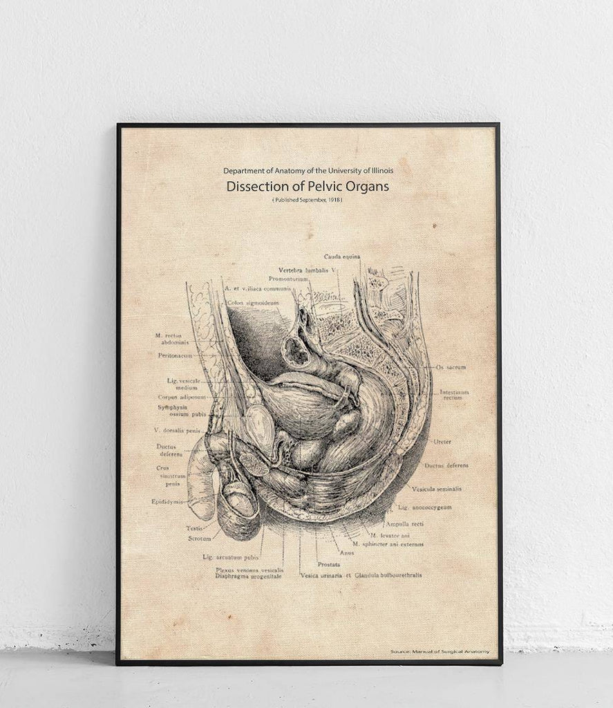 Pelvic dissection - poster